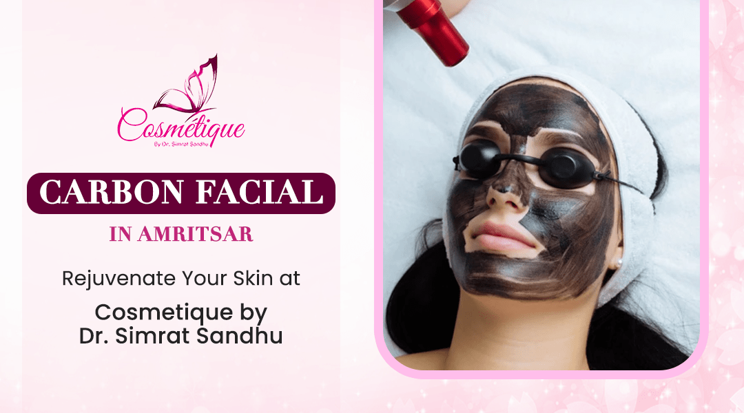 Everything You Need to Know About Carbon Facial in Amritsar